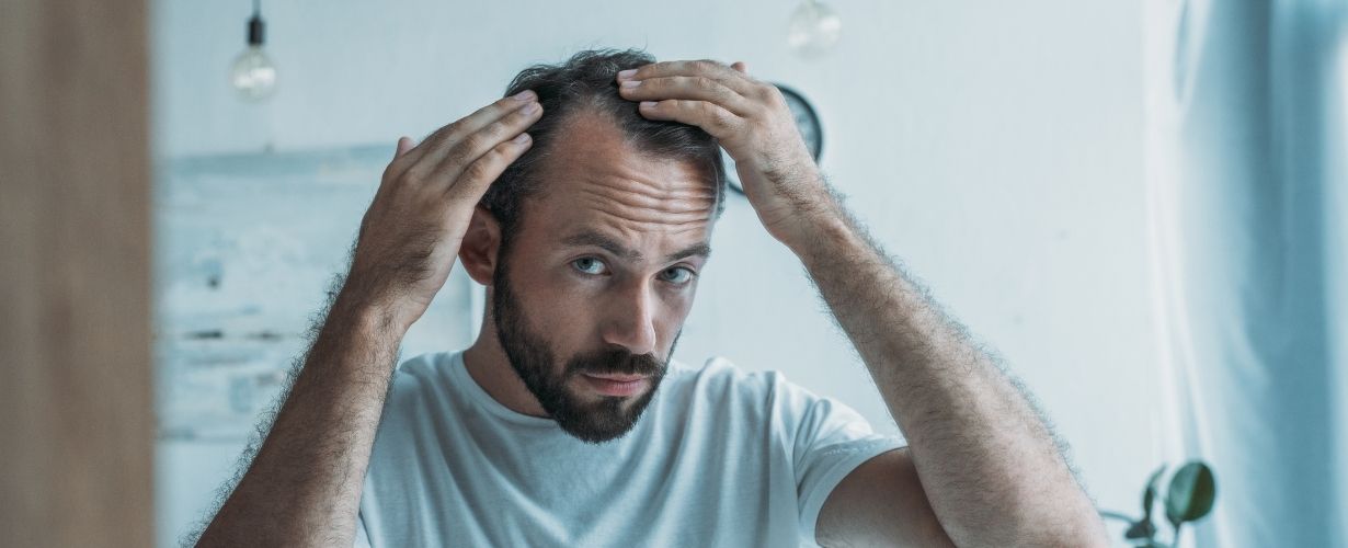 Ca&iacute;da del cabello: &iquest;Sab&iacute;as que puede ser causada por estr&eacute;s?