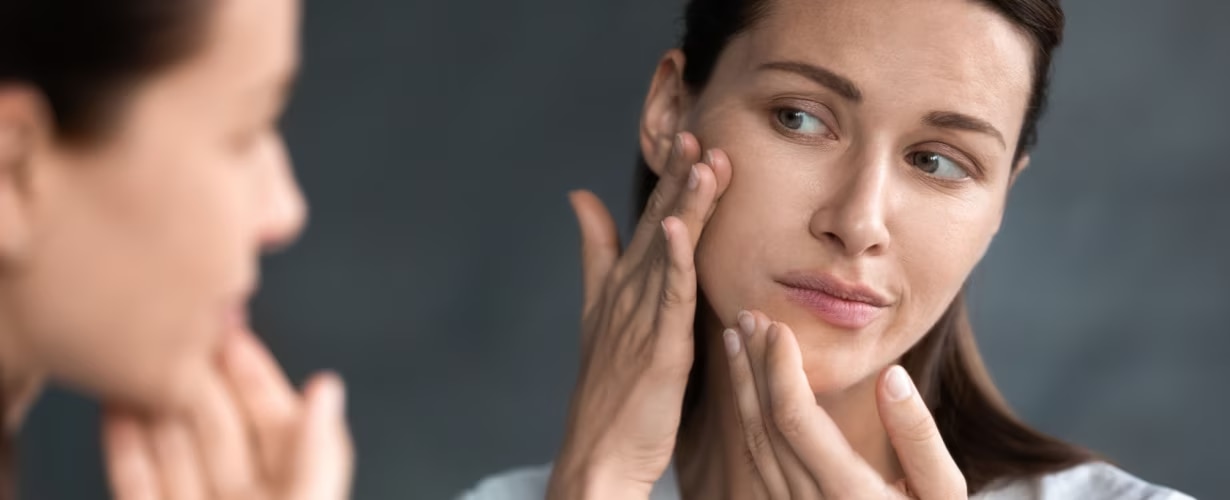 Qu&eacute; son las cremas despigmentantes y c&oacute;mo usarlas