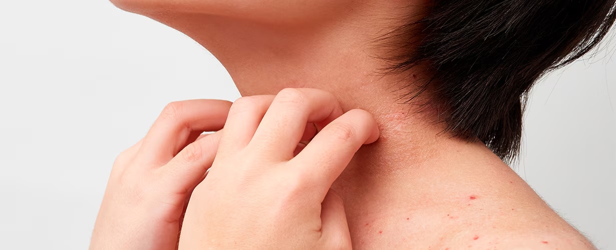 Hablemos de protecci&oacute;n solar